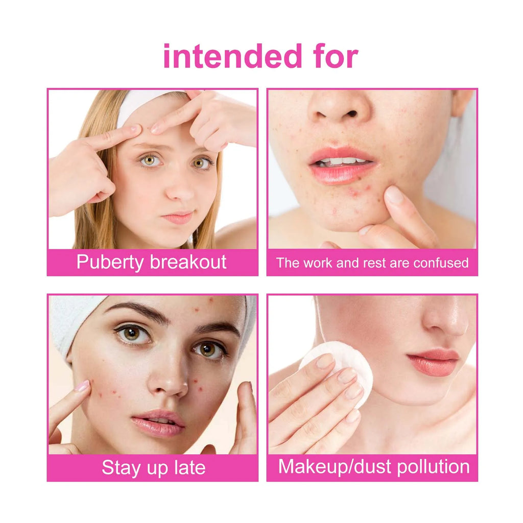 Pimple Patches for Face Cute Butterfly Shaped Acne Patches Hydrocolloid Cute Zit Stickers Parches Para Acne Zpaxo