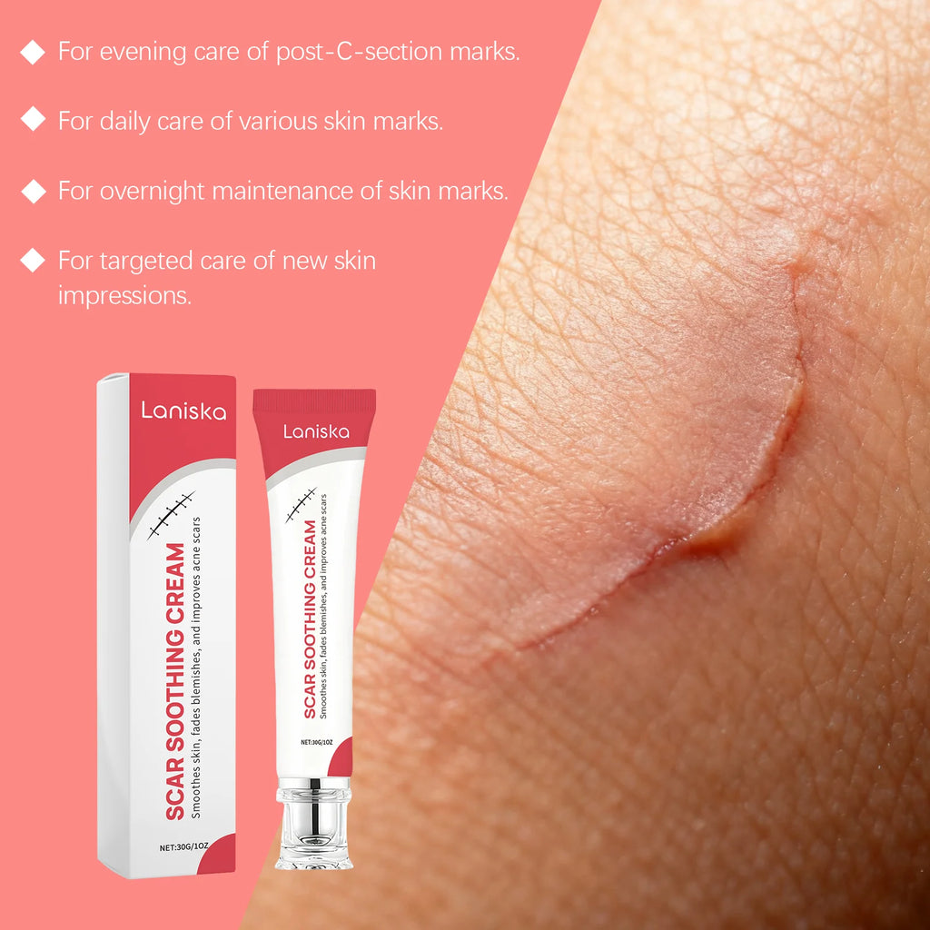 Skin Care Cream Gentle Nourishing Smooth Care for Soft Body Skin Daily Care Cream Zpaxo