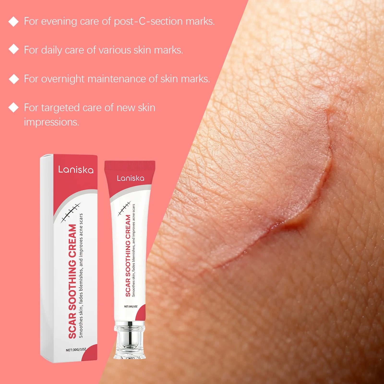 Skin Care Cream Gentle Nourishing Smooth Care for Soft Body Skin Daily Care Cream Zpaxo