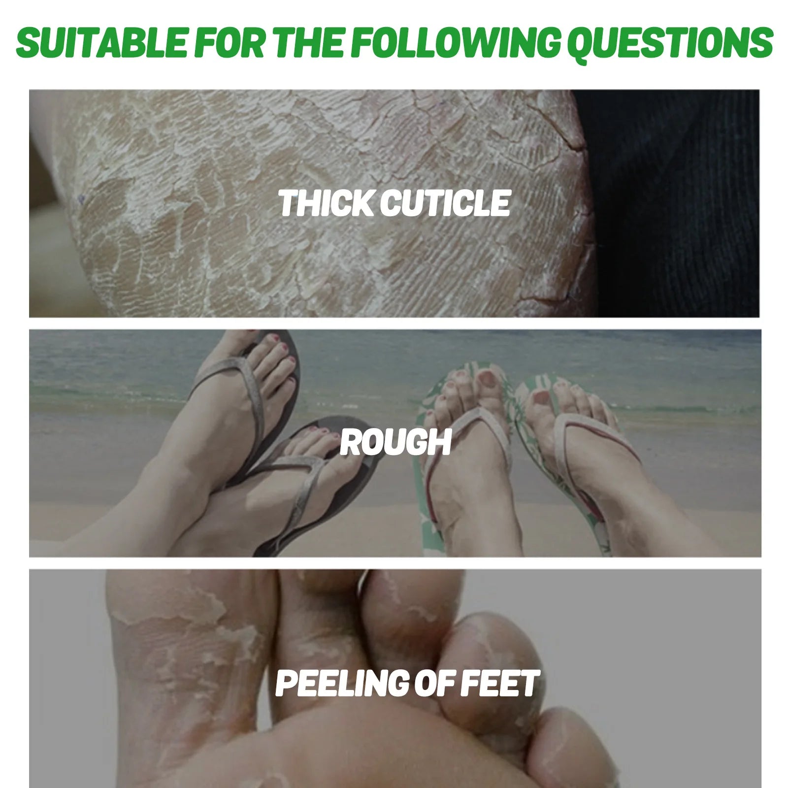Eelhoe Aloe Vera Foot Mask – Moisturizing & Exfoliating 5 Pcs Foot Mask Zpaxo
