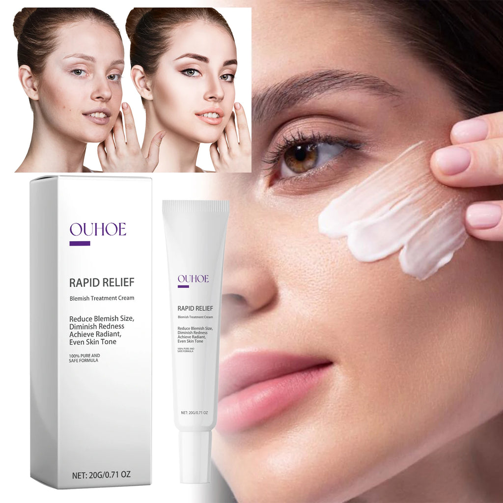 Dark Spot Correcting Brightening Cream 20g Hydrating Face Cream Fades Appearance of Spots Evens Tone Boosts Radiance Acid Aloe Zpaxo