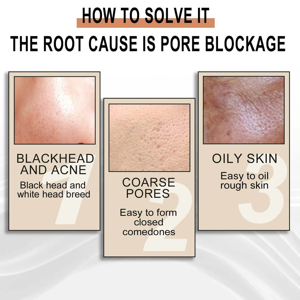 Lactic Acid Essence Removes Blackheads Tightens Pores Deep Cleansing Exfoliation Gently Moisturizes Skin Zpaxo