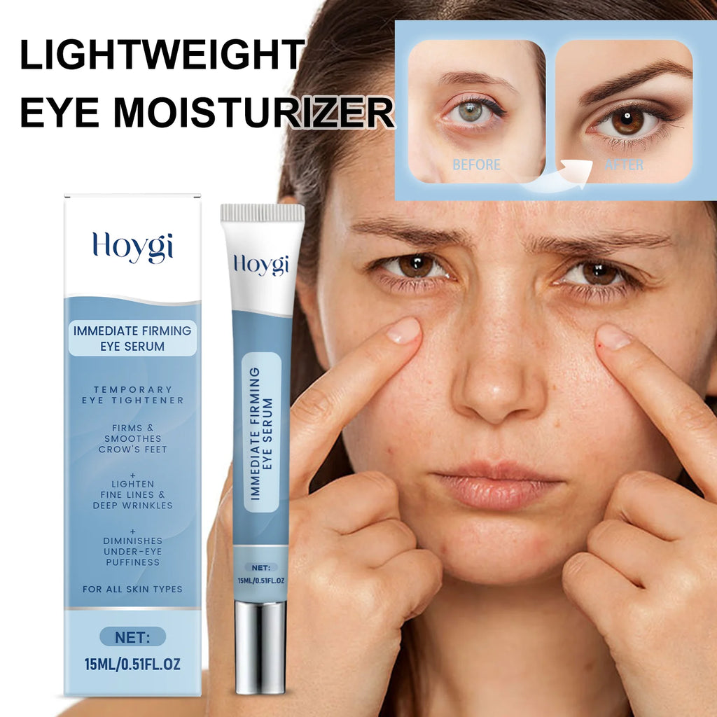 Hydrating Eye Cream for Dark Circles and Puffiness Gentle Moisturizing Formula Reduces Fine Lines 15ml Sensitive Skin Friendly Zpaxo