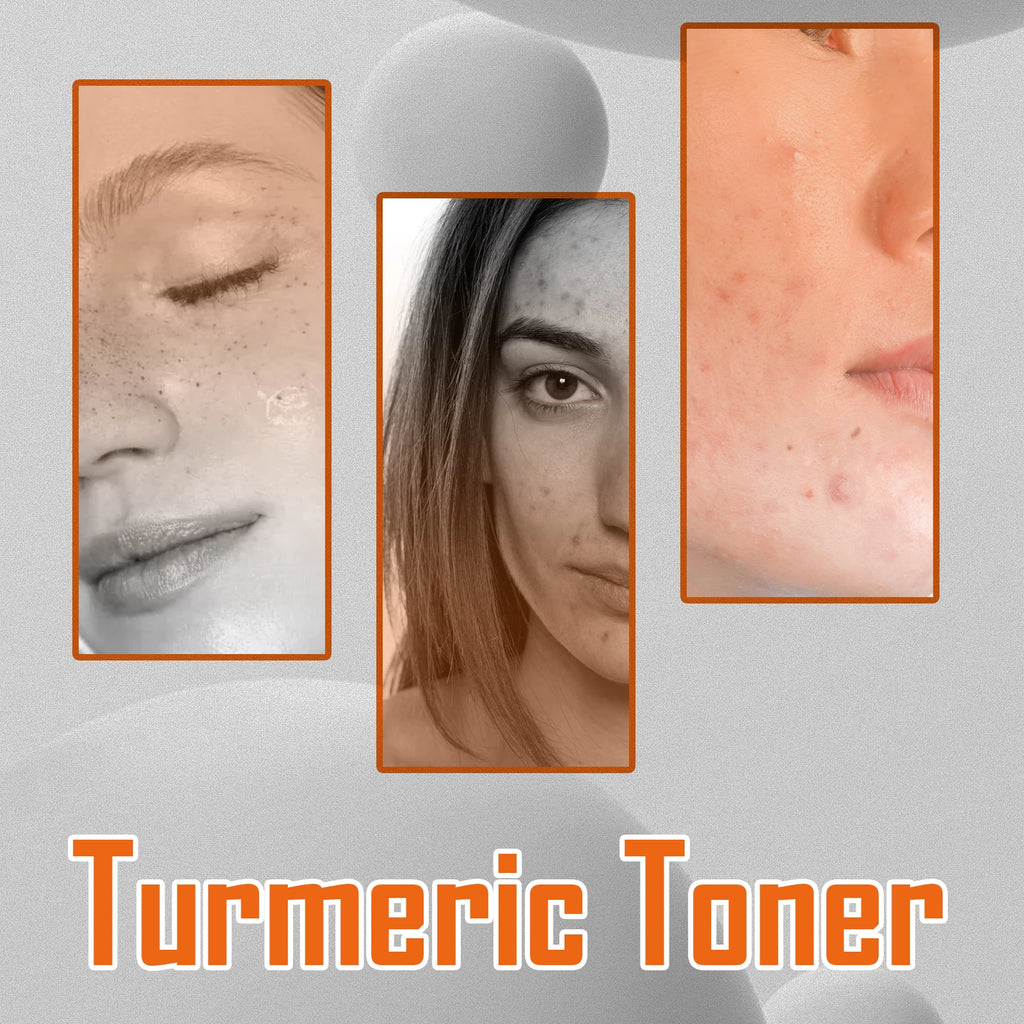 Turmeric Toner Dark Spots Removal Brightening Spots Corrector Remove Freckle Fade Melasma Moisturizing Turmeric Face Toner Zpaxo