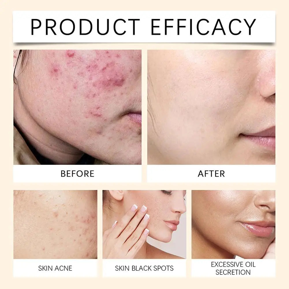 Deep Moisturizing Soothing Face Spray 100ml – Calm Redness Facial Mist Spray Zpaxo