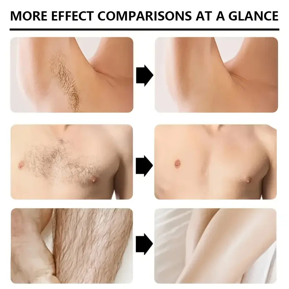 YUITIKUE Men's Hair Removal Cream 100g – Mild Full Body Hair Removal Cream Zpaxo