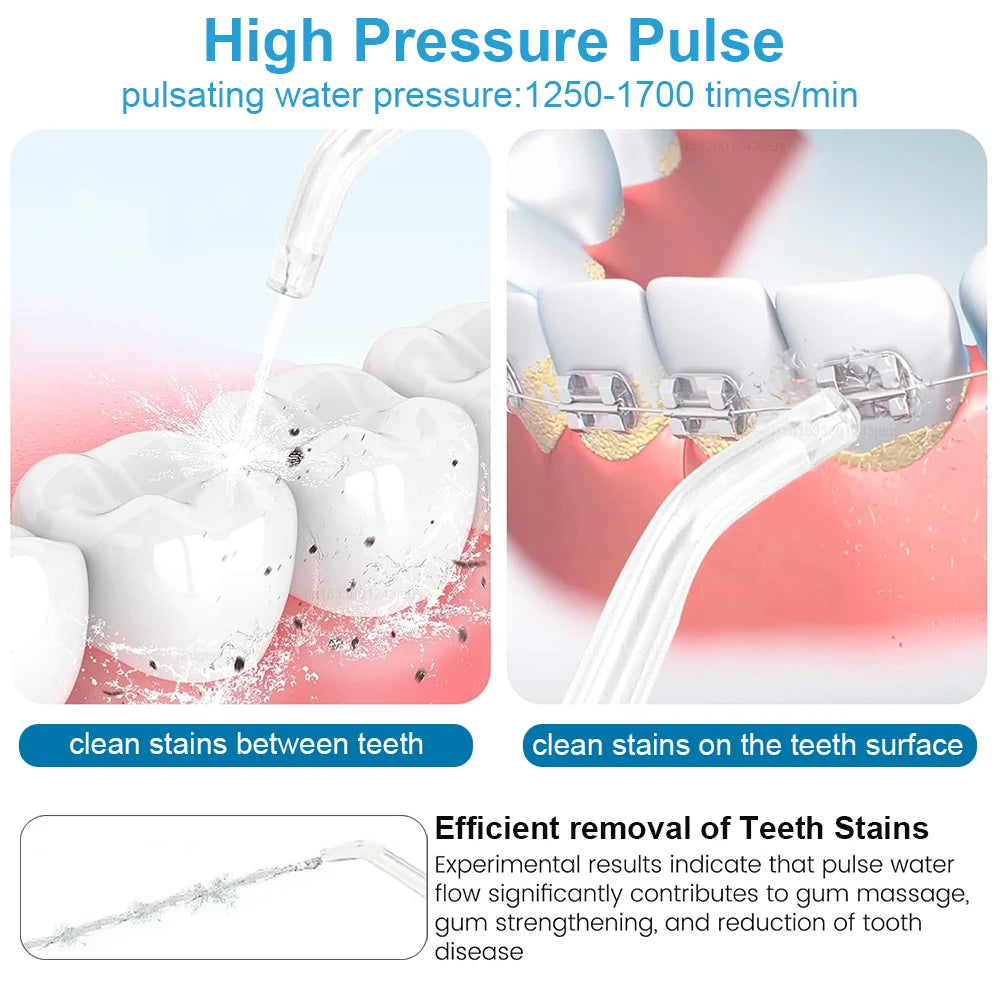 Water Flossser Oral Irrigator Pressure Dental Hygiene Flossing Teeth