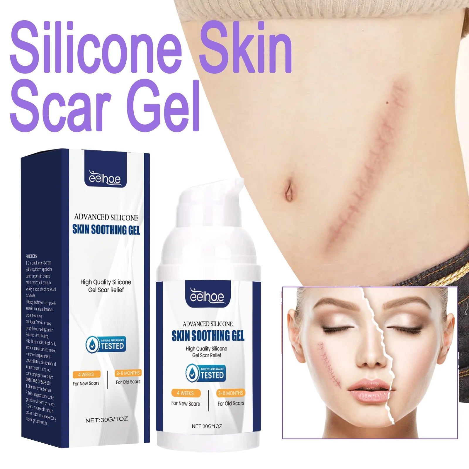 EELHOE Silicone Skin Scar Gel Retinol Niacinamide Scars Stretch Marks Burn Marks Deeply Nourish Skin Reduce Redness Swelling 30g Zpaxo