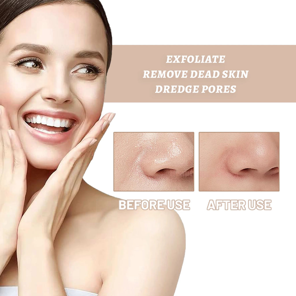 Exfoliating Gel Pore Shrinking Repair Redness Deep Cleansing Remove Dead Skin Dark Spot Brighten Moisturizer Peeling Face Scrub Zpaxo