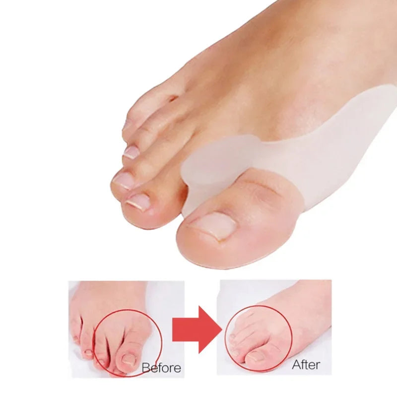 2Pcs=1Pair Silicone Toes Separator Bunion Bone Ectropion Adjuster Toes Outer Appliance Foot Care Tools Hallux Valgus Corrector Zpaxo