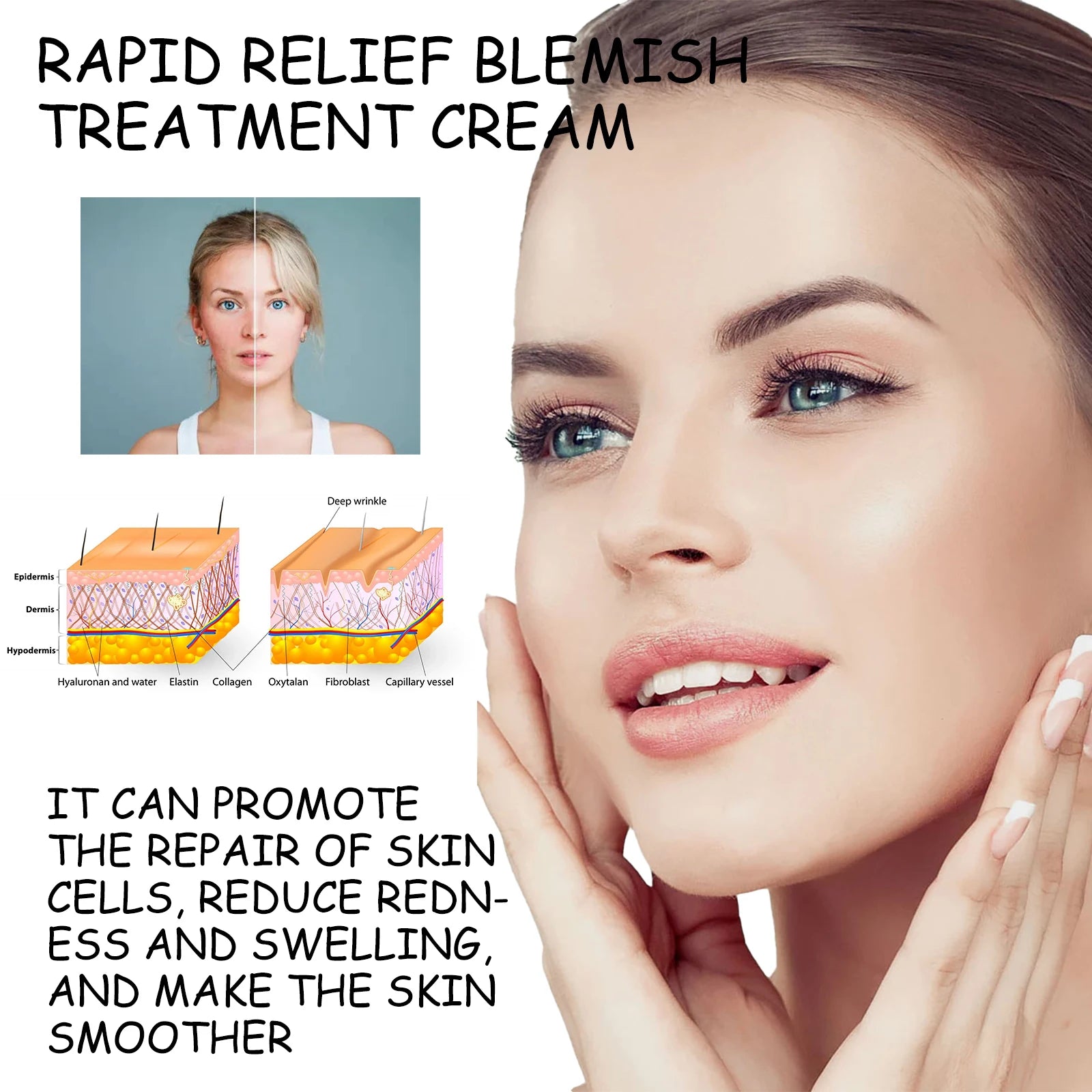 Dark Spot Correcting Brightening Cream 20g Hydrating Face Cream Fades Appearance of Spots Evens Tone Boosts Radiance Acid Aloe Zpaxo