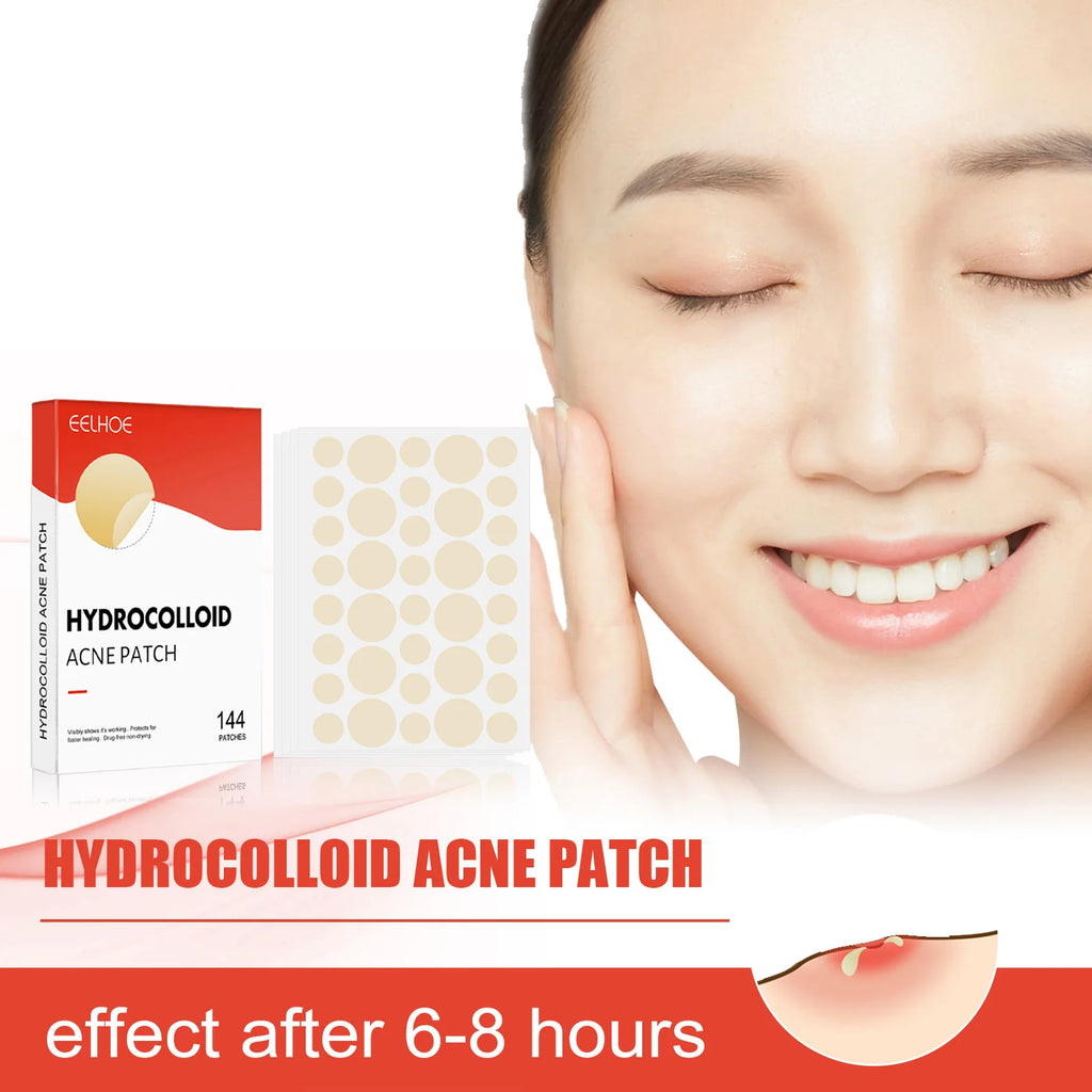 Hydrocolloid Acne Patches 2 Sizes Invisible Makeup-Friendly Pore Care Acne Pimple Patch Breathable for Comedones Treatment Zpaxo