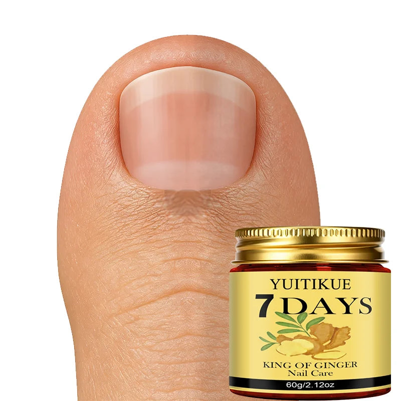 YUITIKUE 7-Day Ginger King Nail Care Cream – Renew Nails 60g Nail Treatment Cream Zpaxo