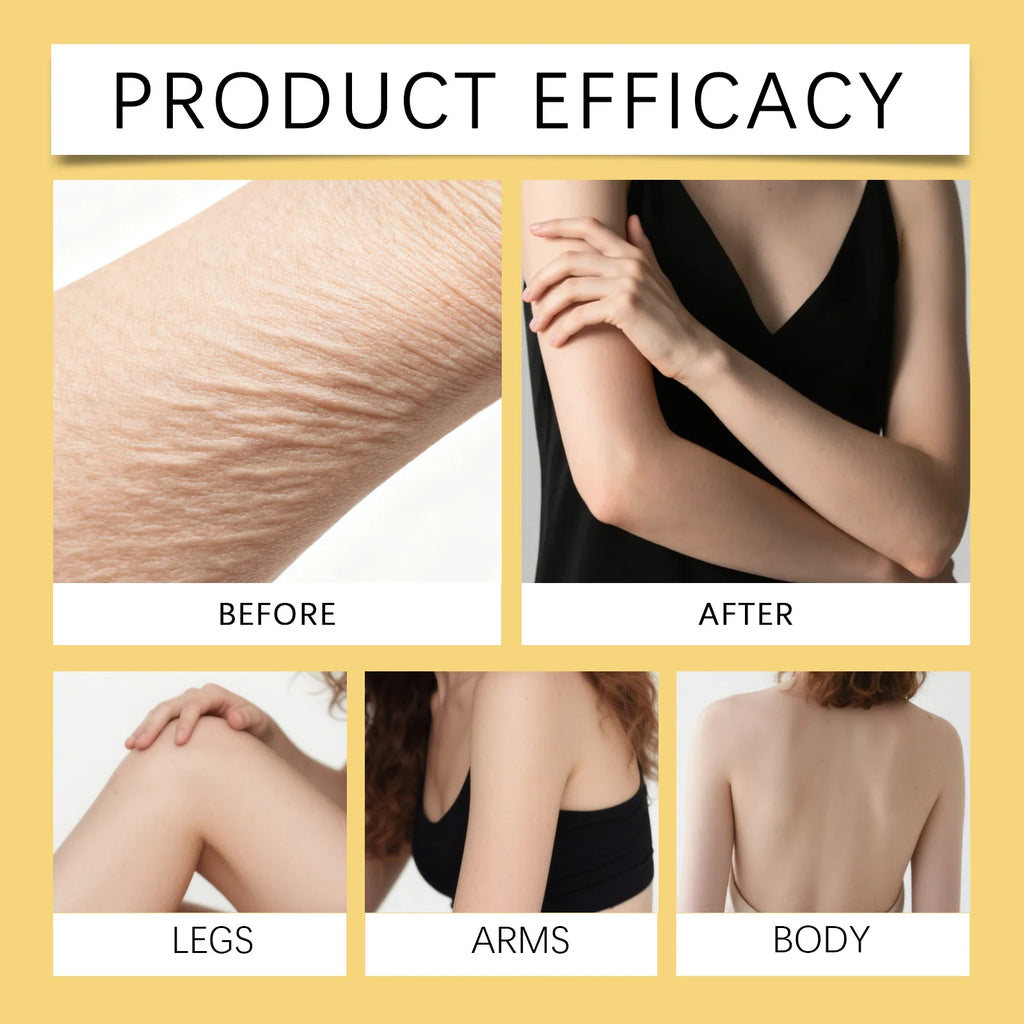 Coconut Body Oil Firming & Moisturizing Skin Care for Body Butt Chest Vitamin Enriched Dry Skin Remedy Nourishing Fast Absorbing Zpaxo