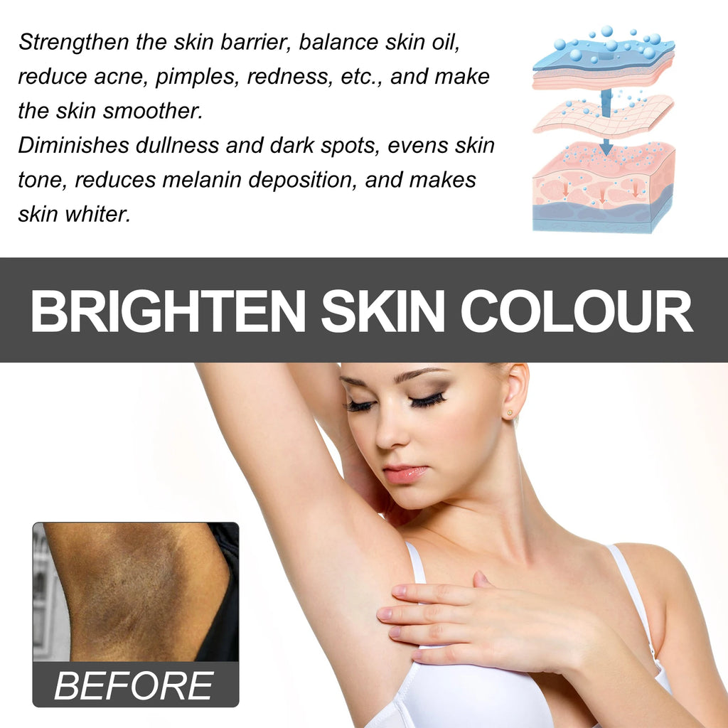 Dark Spot Corrector Cream for Underarm Inner Thigh Knee Whitening Cream Body Brightening Cream with Niacinamide Vitamin C 30ml Zpaxo
