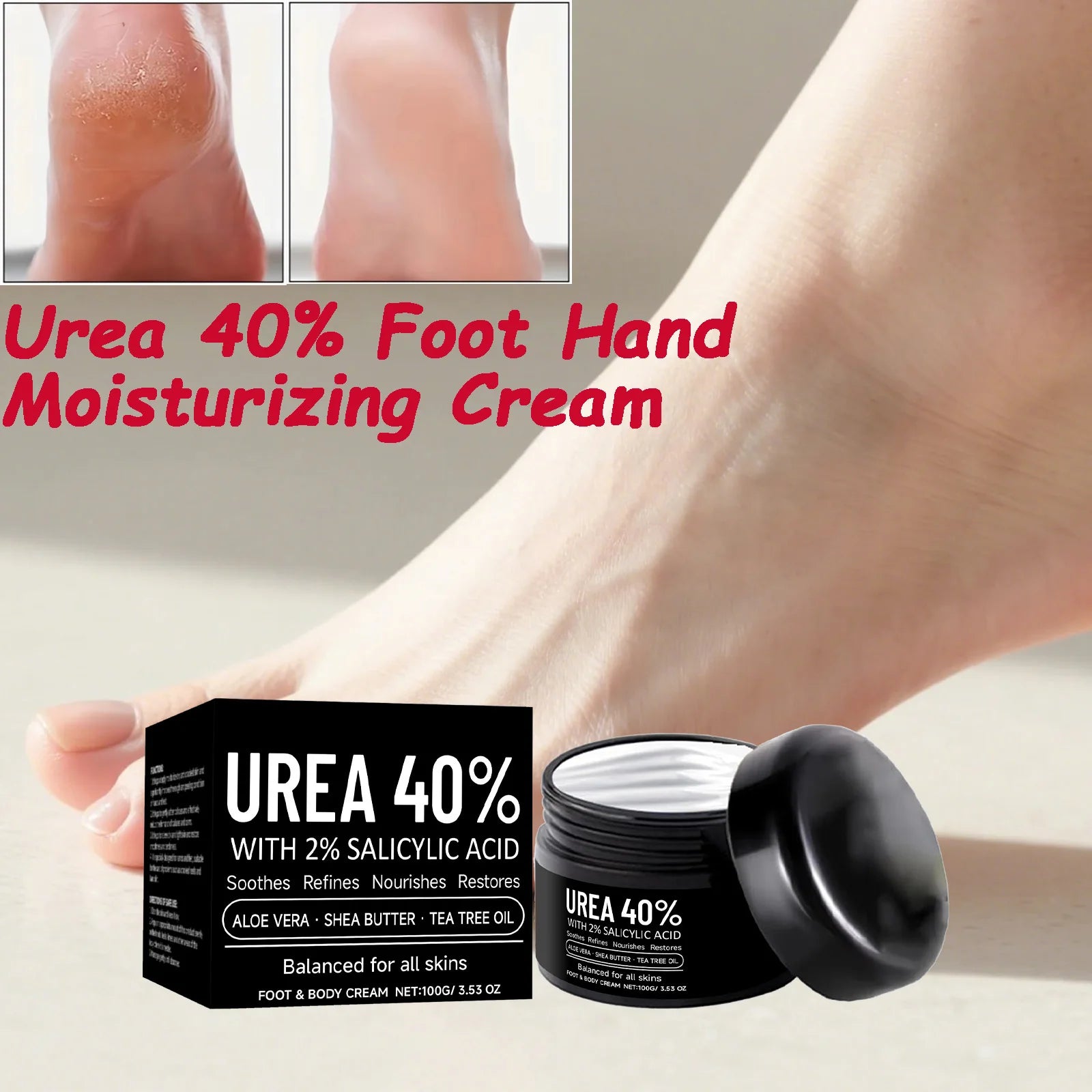Hoygi 40% Urea Foot & Hand Cream – Cracked Heel Moisturizer Foot & Hand Cream Zpaxo