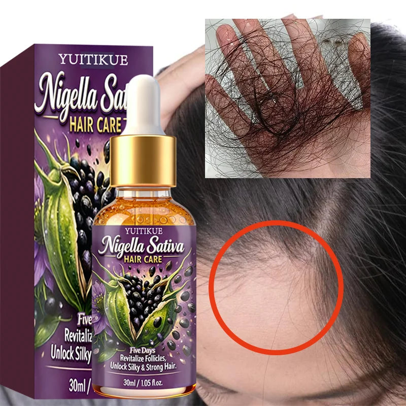 YUITIKUE Nigella Sativa Hair Oil – Nourish Scalp & Strengthen Hair Hair Treatment Oil Zpaxo
