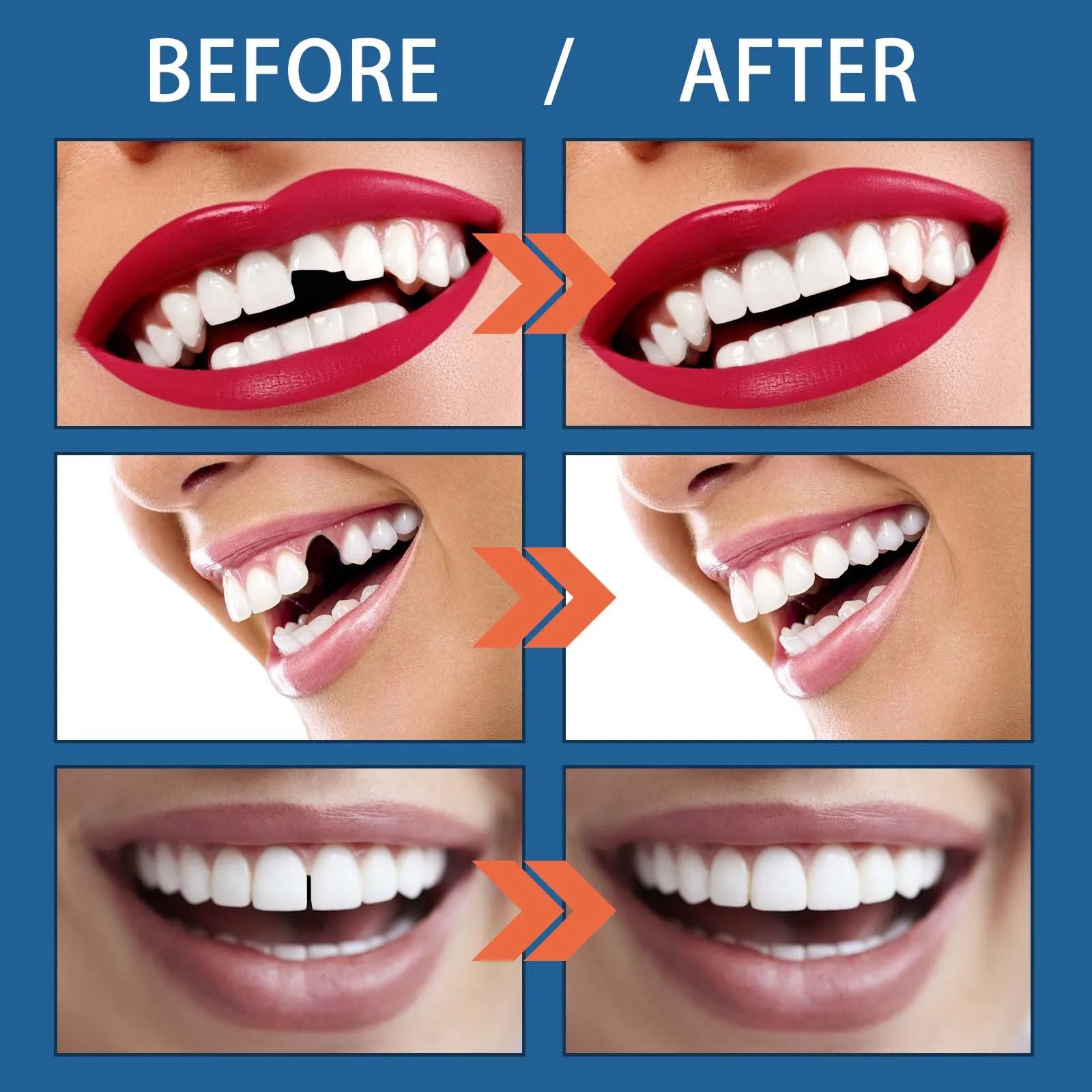 Solid Dental Gel, Vampire Fake Teeth for Halloween Cosplay Costume Party, Tooth Repair Gel & Tooth Cavity Filler Zpaxo