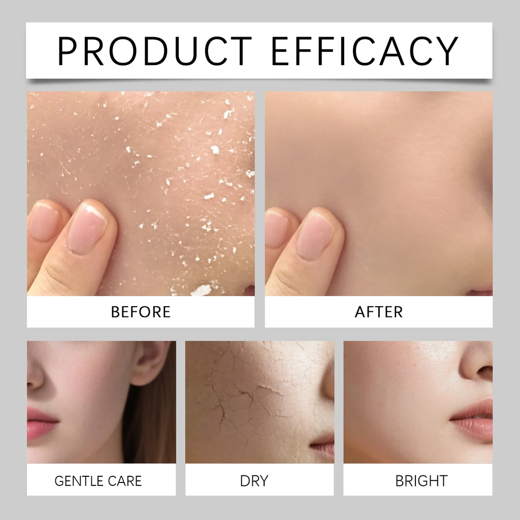 80ml Facial Moisturizer Spray for Winter Skincare Dry Skin Remedy Deep Hydration Lock Radiant Holiday Special Mist Sensitive Zpaxo