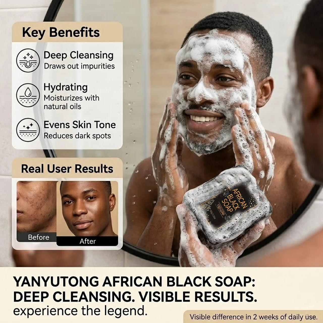 African Black Soap with Shea Butter – Deep Cleanse & Hydrate Handmade Bar Soap Zpaxo