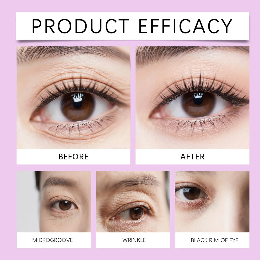 Eye Cream Dark Circles Puffiness Anti Aging Wrinkle Women Hydrating Zpaxo