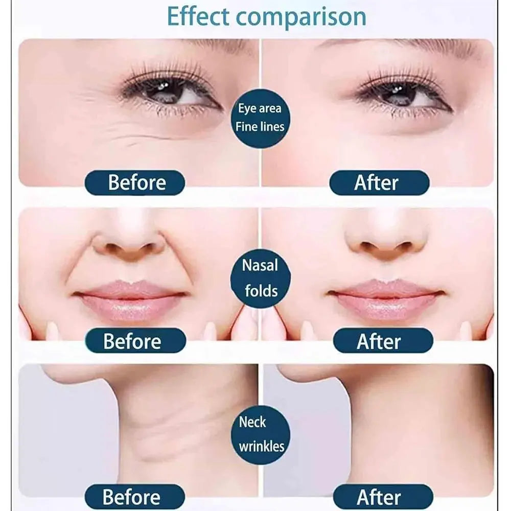 Hot Toning Japanese Face Tape Firming Anti-Wrinkle Face Toning Belts Tightening Skin Face Lift Tape Unisex Zpaxo