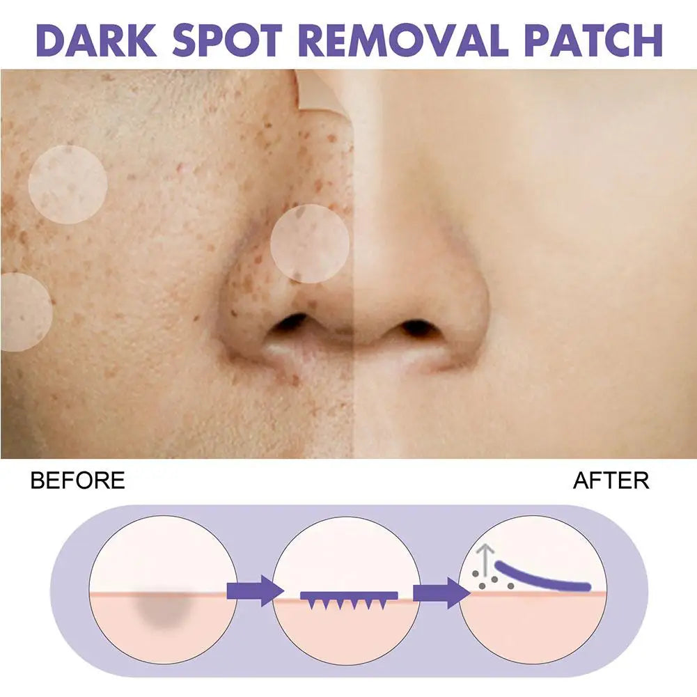 Eelhoe Invisible Acne Patches – Face Spot Stickers 144pcs Acne Spot Patches Zpaxo