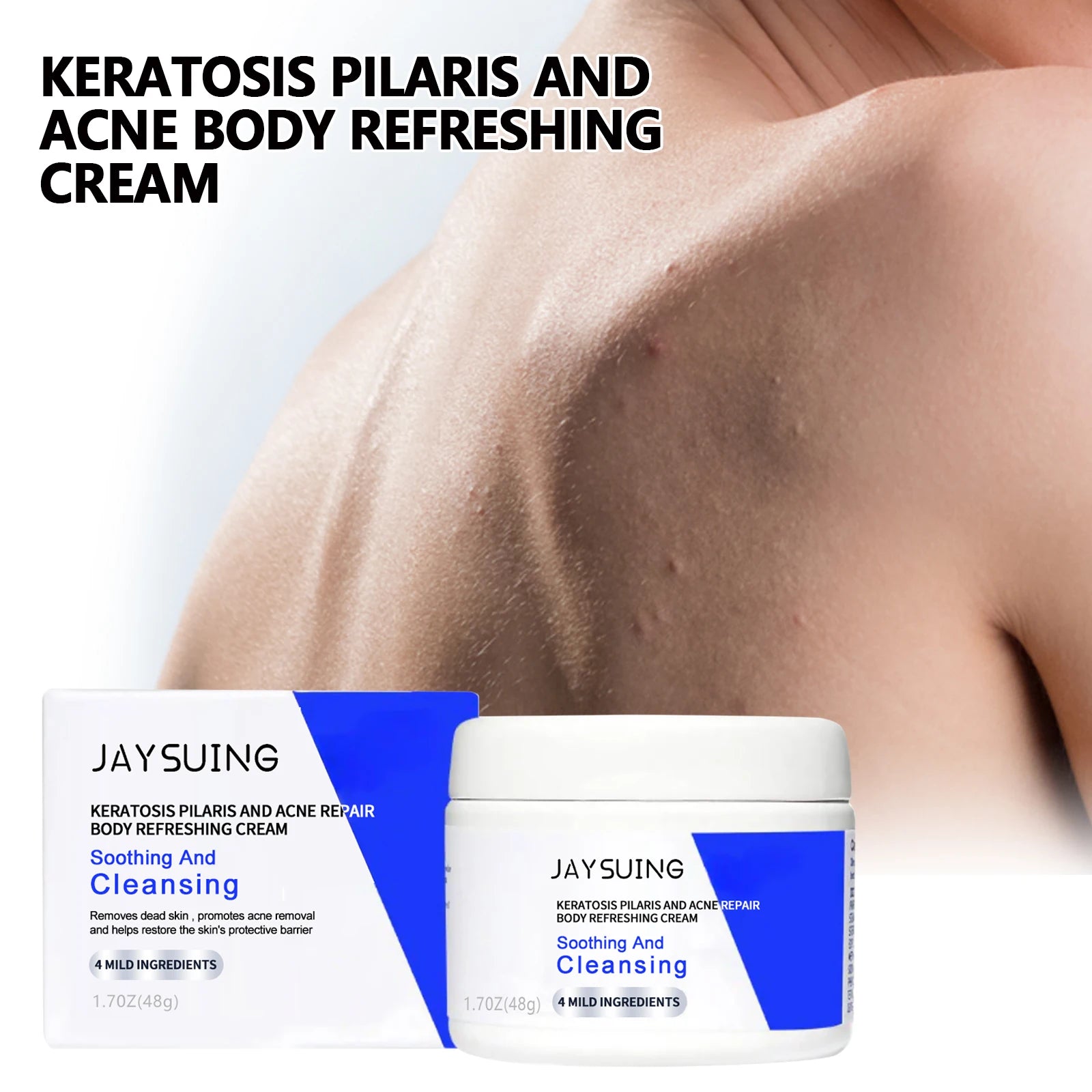 Chicken Skin Repair Cream Curing Body Keratosis Pilaris Remove Acne Sp-ot Rough Bumpy Pore Moisturizing Smooth Whi-tening Lotion Zpaxo
