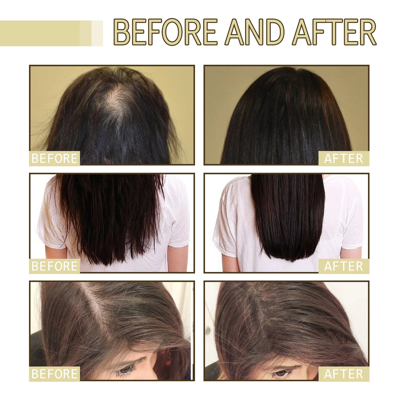 Rosemary Hair Growth Oil 60ml Anti Hair Loss Treatment For Thicker Hair Repairing Dry Damaged Hair Scalp Care With Argan Oil Zpaxo
