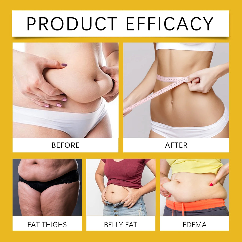 Hoygi Bee Venom Shaping Oil Firming Lifting Body Skin Anti Cellulite Fat Burning Weight Loss Improve Sagging Thin Leg Massage Oi Zpaxo