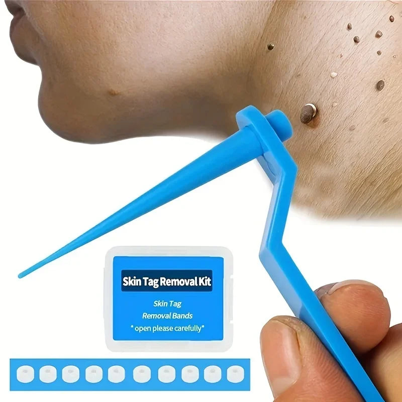 1 Set Skin Tag Removal Kit Skin Mole Wart Remover Micro Band Skin Tag Removal Kit Tag Treatment Tools Set with Cleansing Swabs Zpaxo