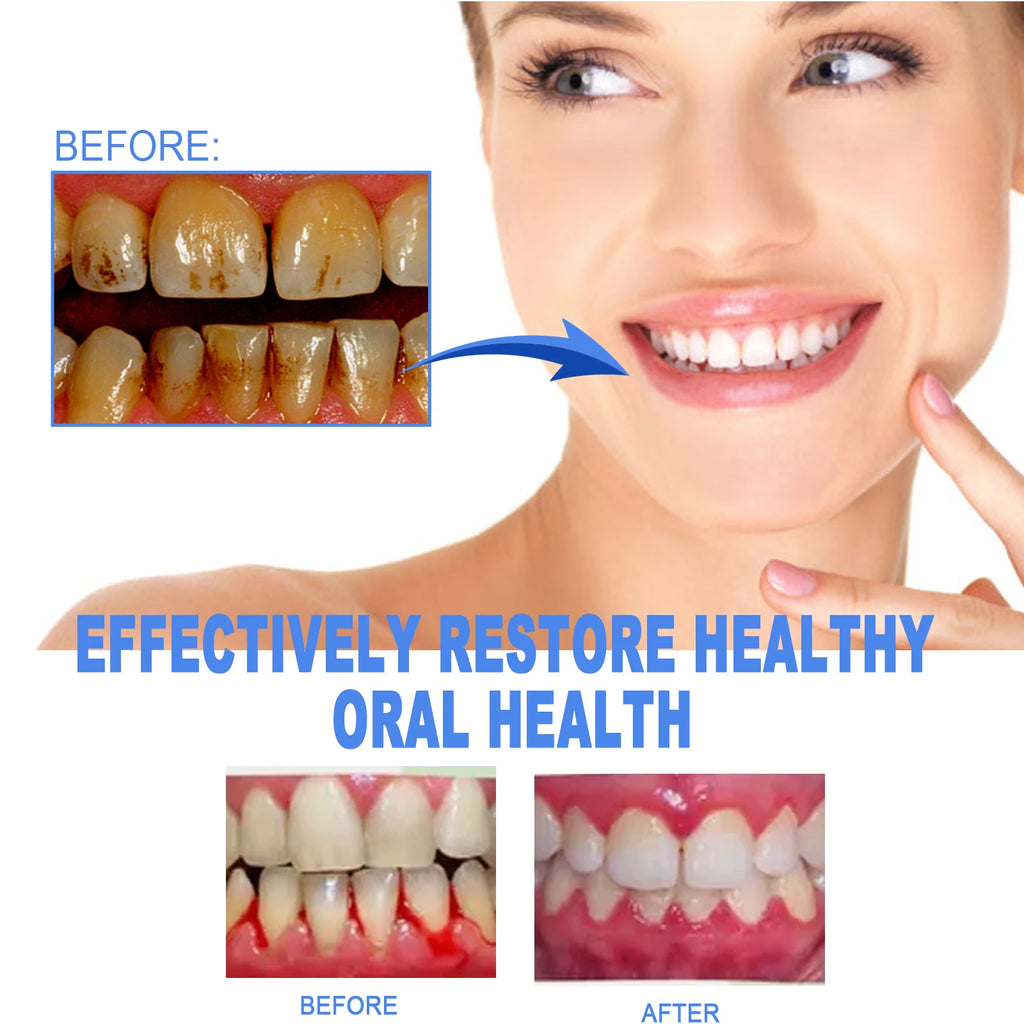 EELHOE Gum Protect Repair Gels Gently Apply Penetrate Quickly Mild Non-Irritating Small Portable Suitable For Every Teeth Type Zpaxo