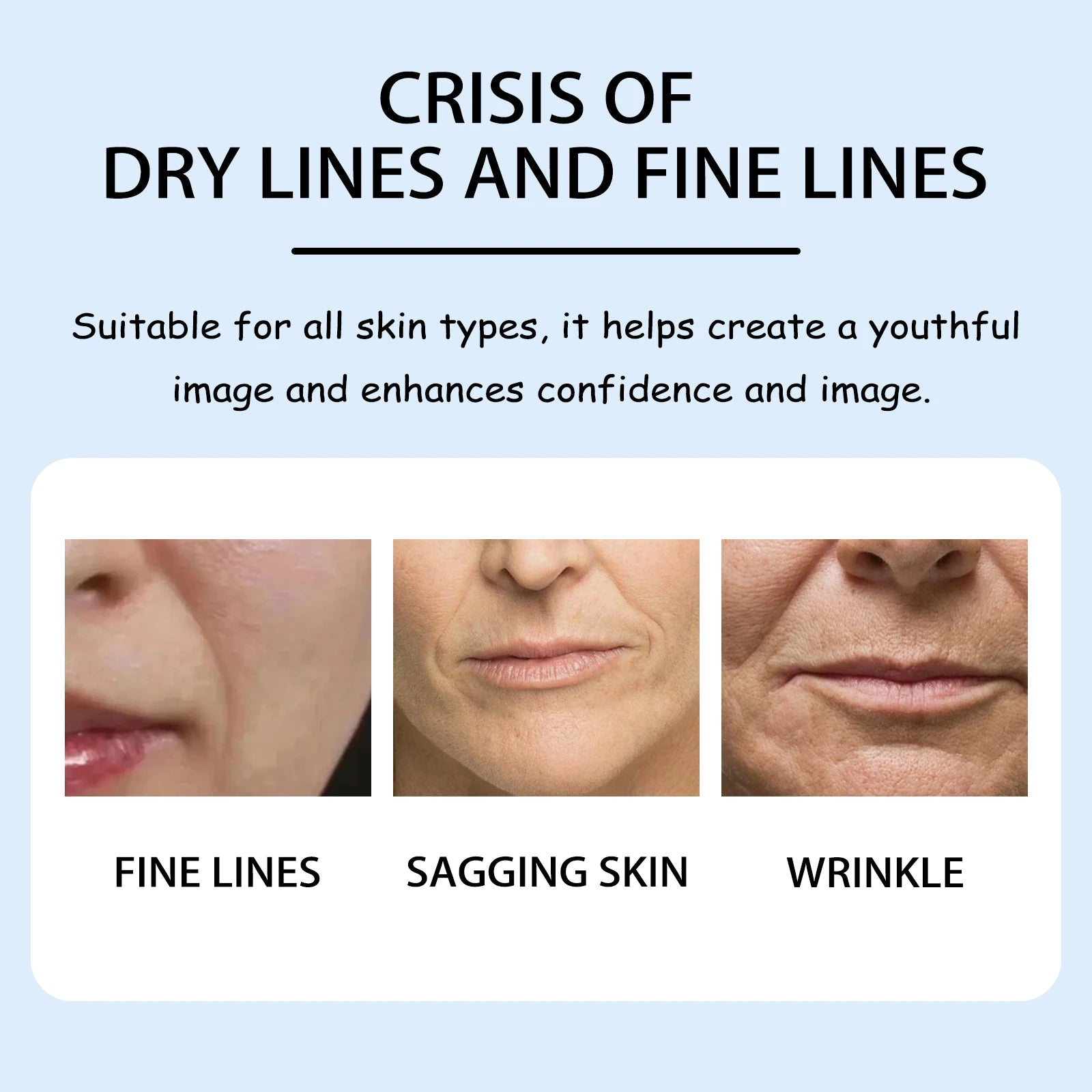 Nasolabial Fold Gel Patches – Anti-Wrinkle & Firming | Eelhoe Anti-Wrinkle Face Patches Zpaxo