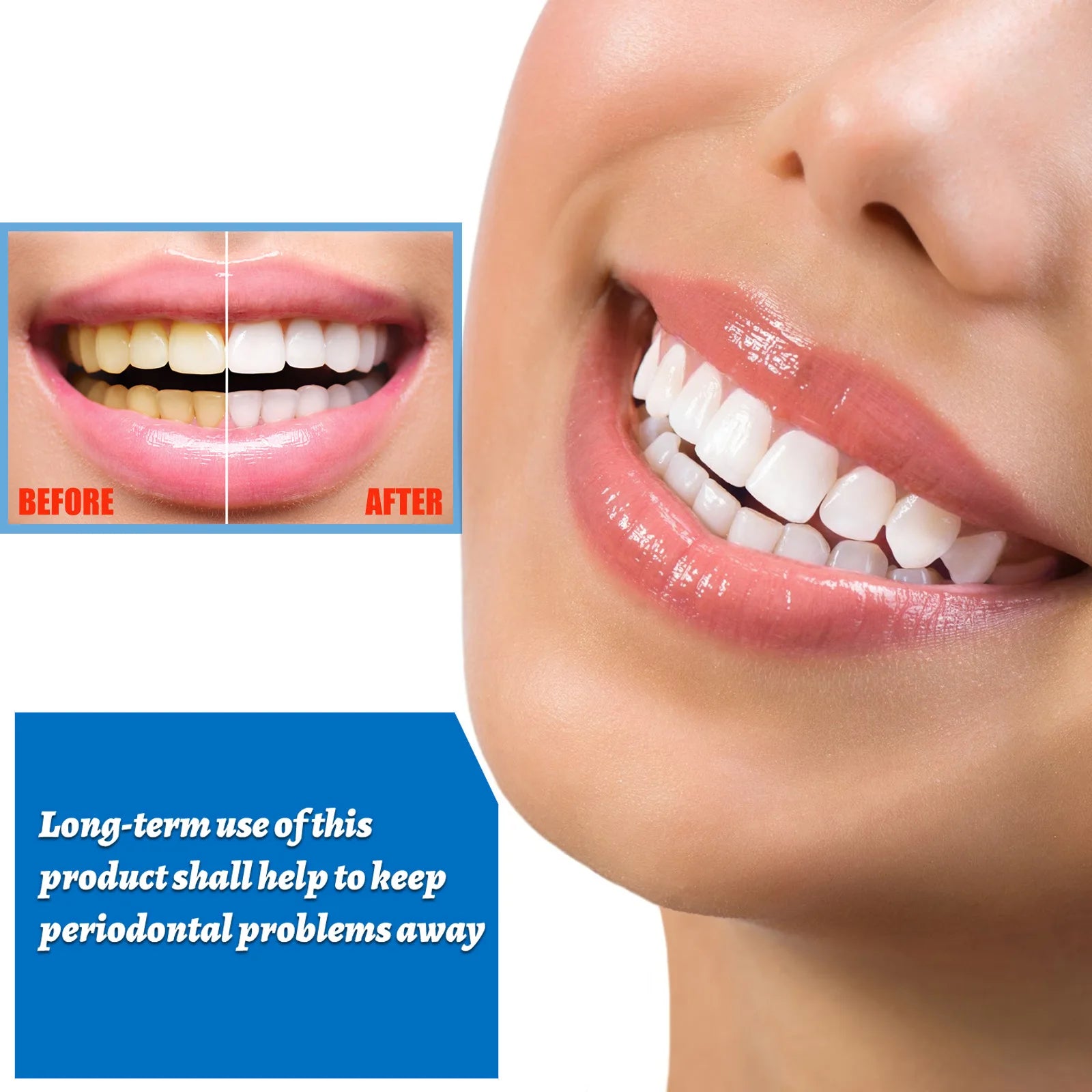 EELHOE Teeth Whitening Serum | Plaque & Stain Remover Teeth Whitening Serum Zpaxo