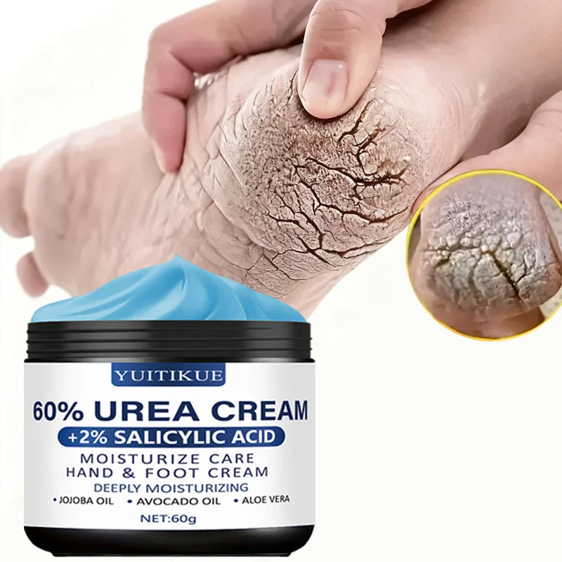 YUITIKUE 60% Urea Foot Cream – Dry Heels & Rough Skin 60g Urea Foot Cream Zpaxo