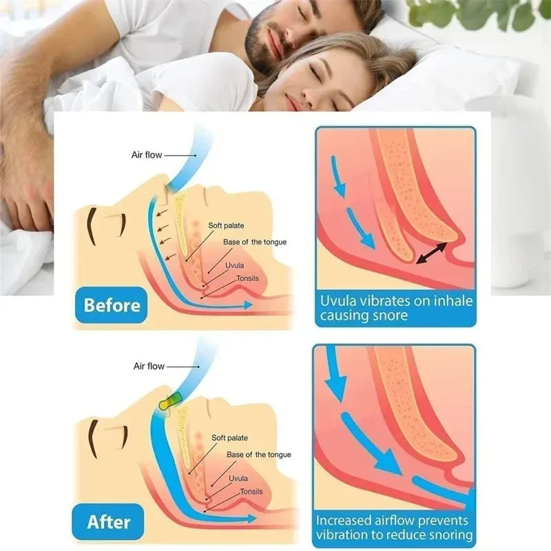 Silicone Magnetic Nose Clip – Anti-Snore Sleep Aid with Case