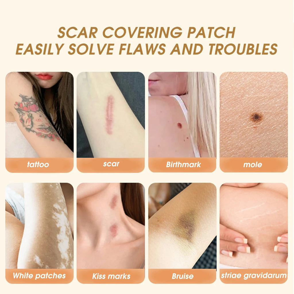 Invisible Skin Tattoo Patches Natural-looking Birthmark Concealer