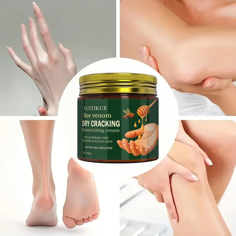 Bee Venom Repair Cream 60g – Dry & Cracked Hands & Feet Foot & Hand Cream Zpaxo