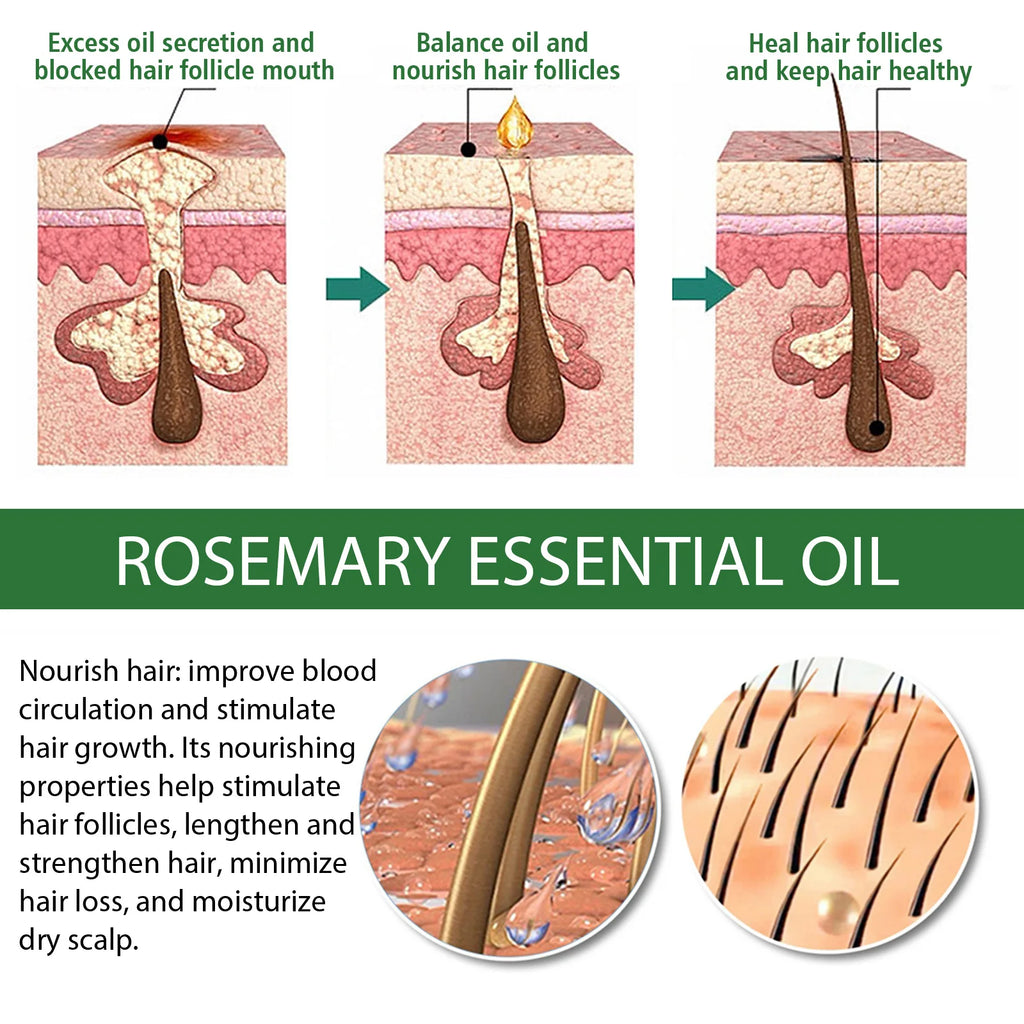Rosemary Essential Oil 60ml Hair Growth Serum Scalp Treatment Skin Care Anti Aging Vitamin E Enriched for Thicker Hair Glowing Zpaxo