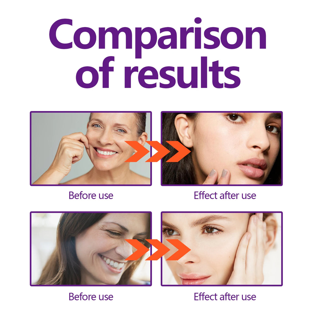 Hoygi Lifting Firming Face Cream Collagen Peptides Contouring Hydration All Skin Types Fast Absorbing Non-Greasy Zpaxo