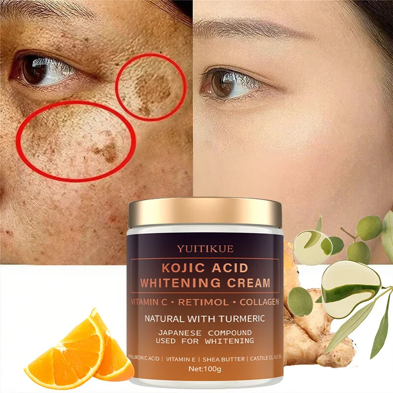 Kojic Acid Whitening Cream 100g | Vitamin C, Turmeric & Hyaluronic Skin Brightening Cream Zpaxo