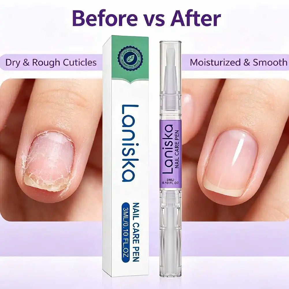 Nail Cuticle Oil Pen 3ml – Nourishing Repair & Hydration Cuticle Oil Pen Zpaxo