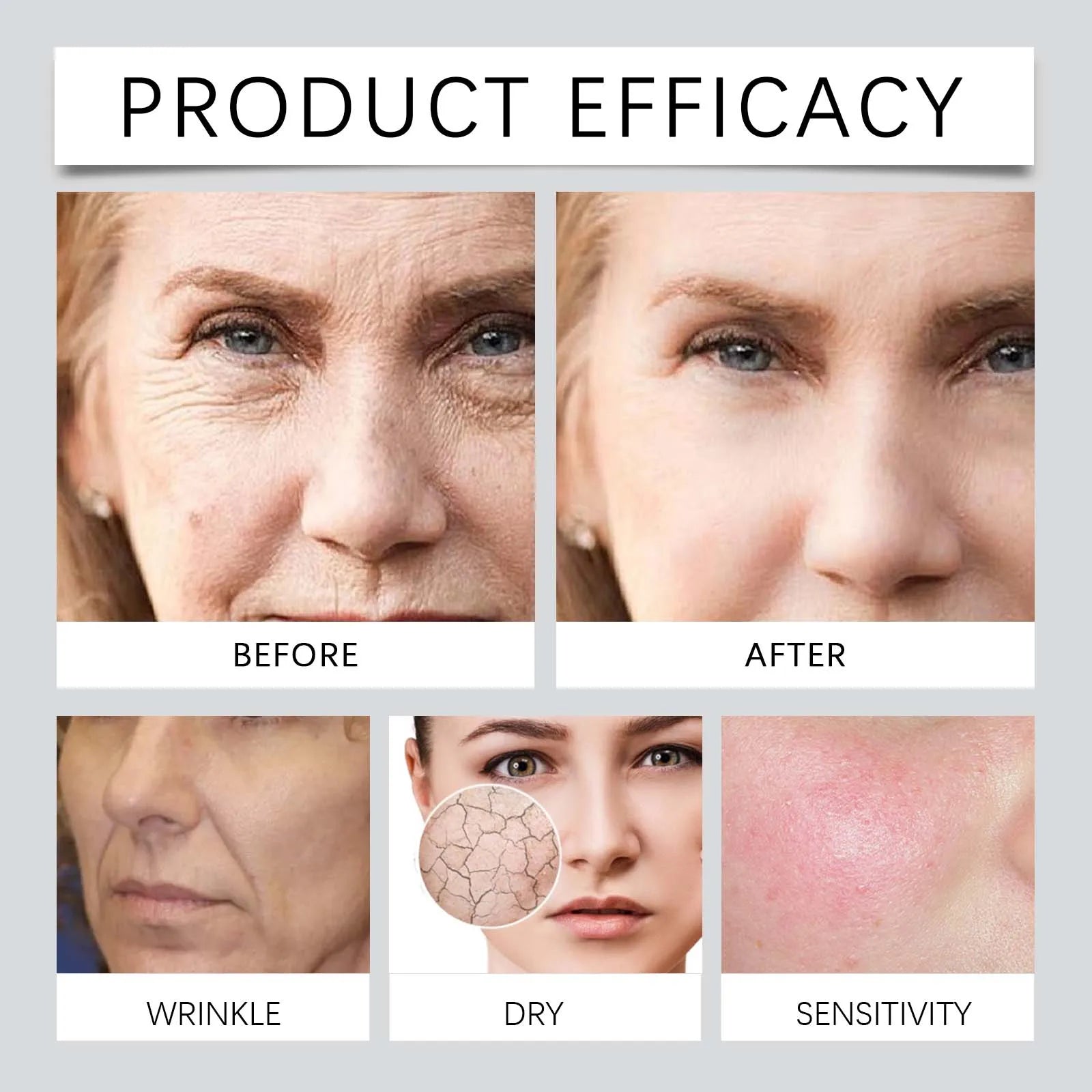 Daily Moisturizer Deep Hydration Lock Night Cream Stabilizing Zpaxo