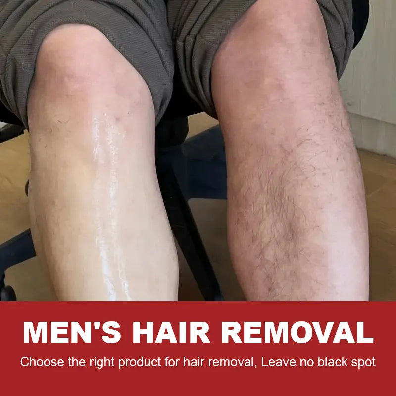YUITIKUE Men's Hair Removal Cream – Painless & Nourishing 100g Hair Removal Cream Zpaxo
