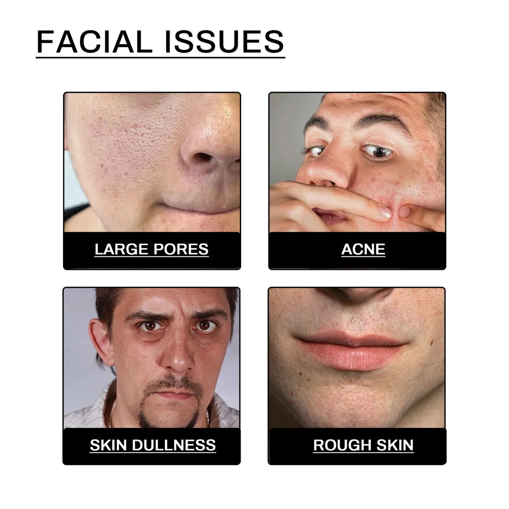 East Moon Men's Face Wash – Oil Control, Acne & Pore Cleanser Men's Facial Cleanser Zpaxo