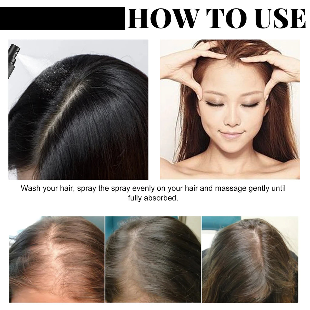 Jaysuing Natural Batana Oil Hair Spray Anti Hair Loss Hair Care Promotes Hair Growth Suitable for Men and Women Hair Conditioner Zpaxo