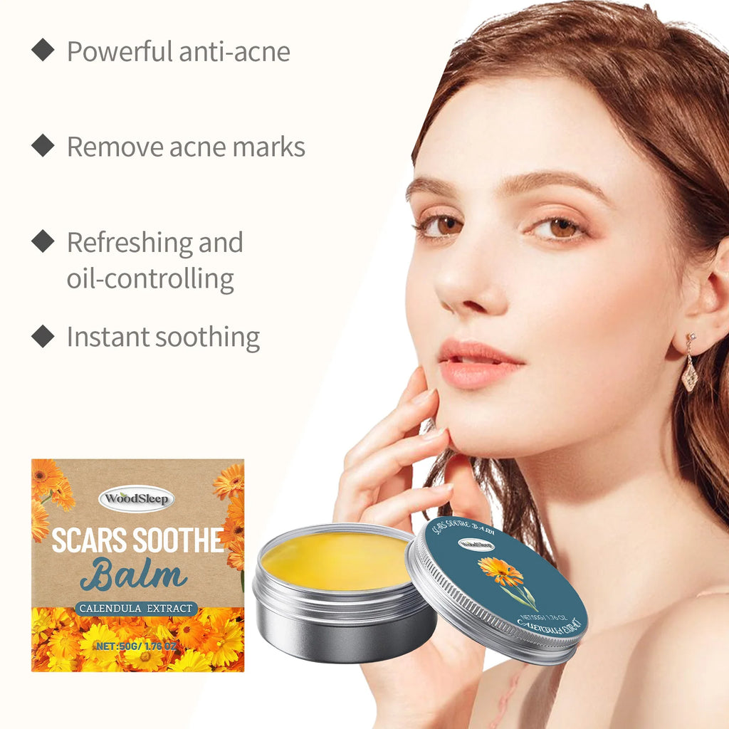 Calendula Anti-Acne Cream – Oil Control, Fade Marks & Pores Acne Face Cream Zpaxo