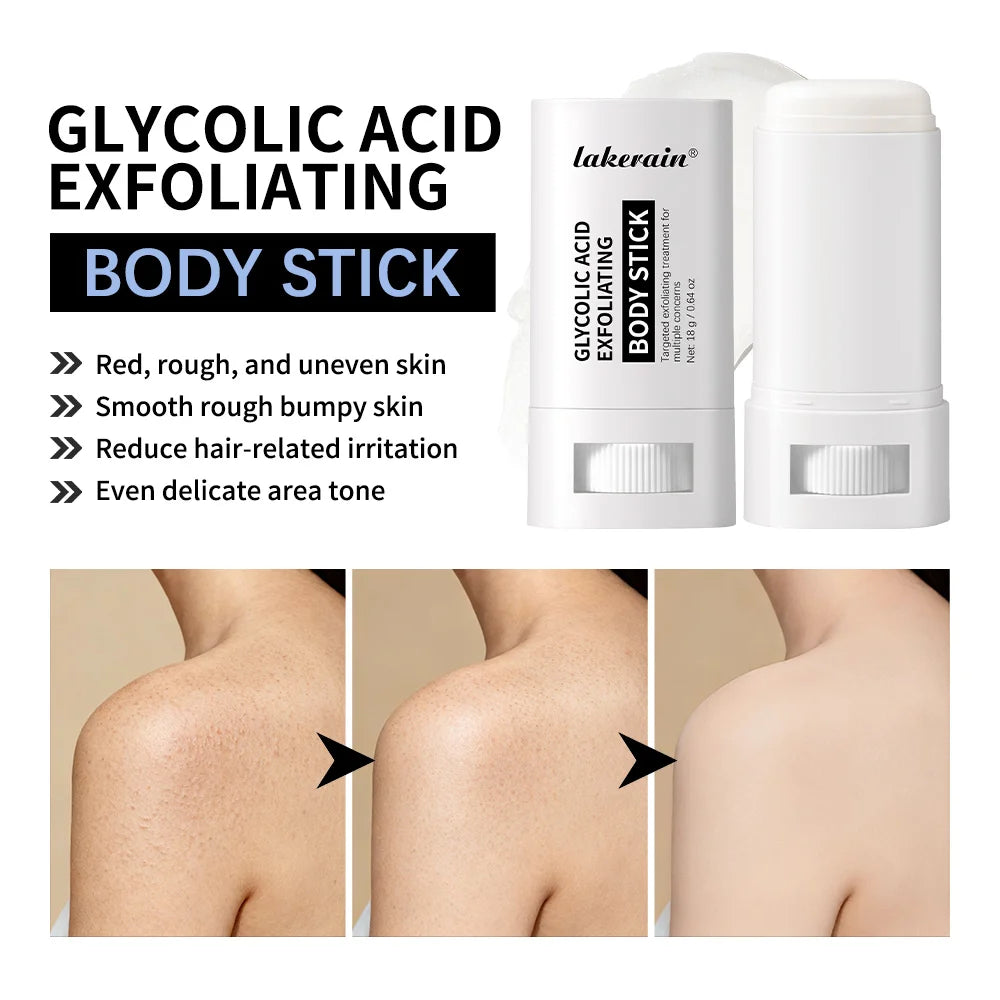 Glycolic Acid Exfoliating Body Stick Multiple Concerns Delivers Deep Effective Exfoliation Nourishing Moisture Deep Hydration Zpaxo