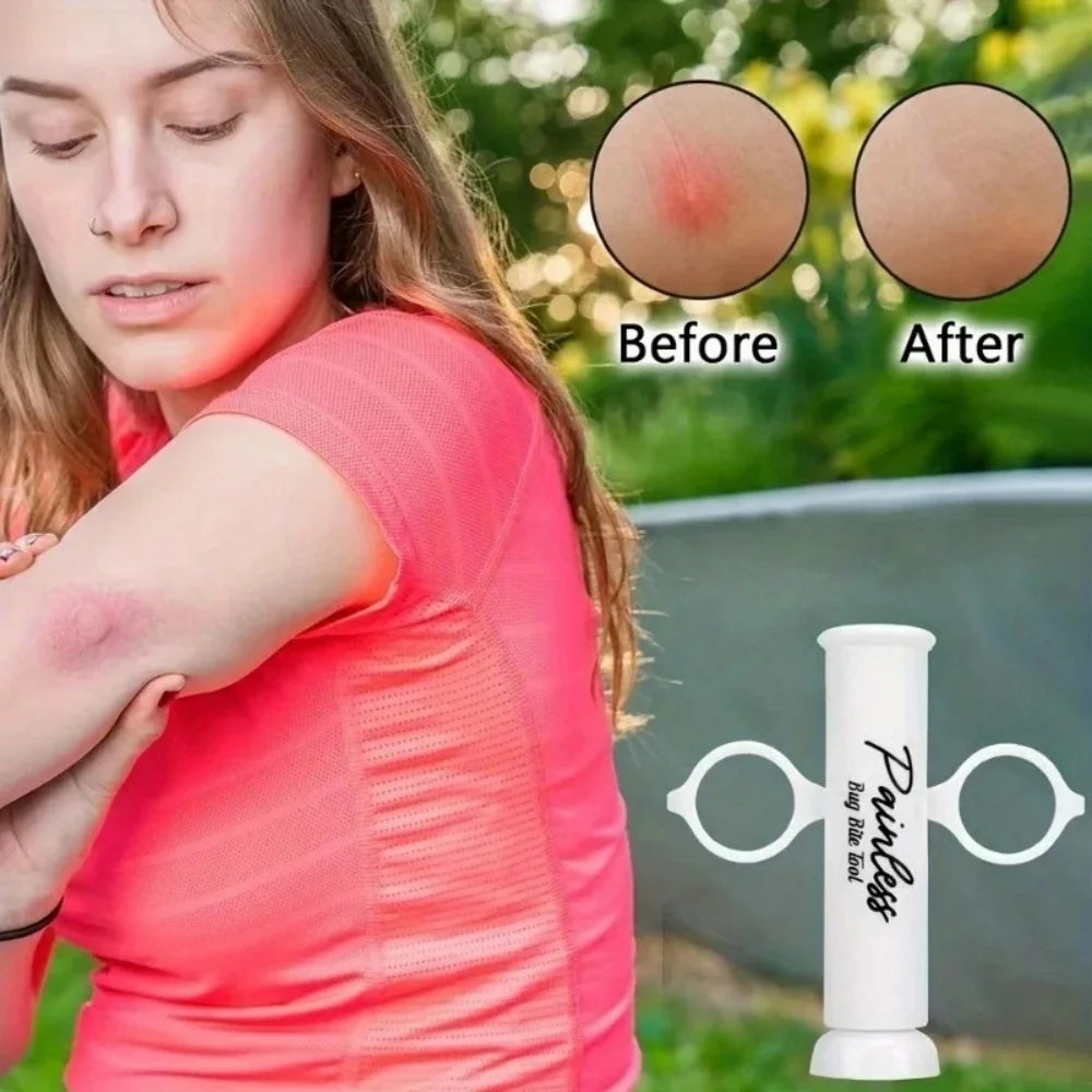 Vacuum Venom Extractor Pump – Bee & Insect Bite First Aid Kit Venom Extractor Pump Zpaxo
