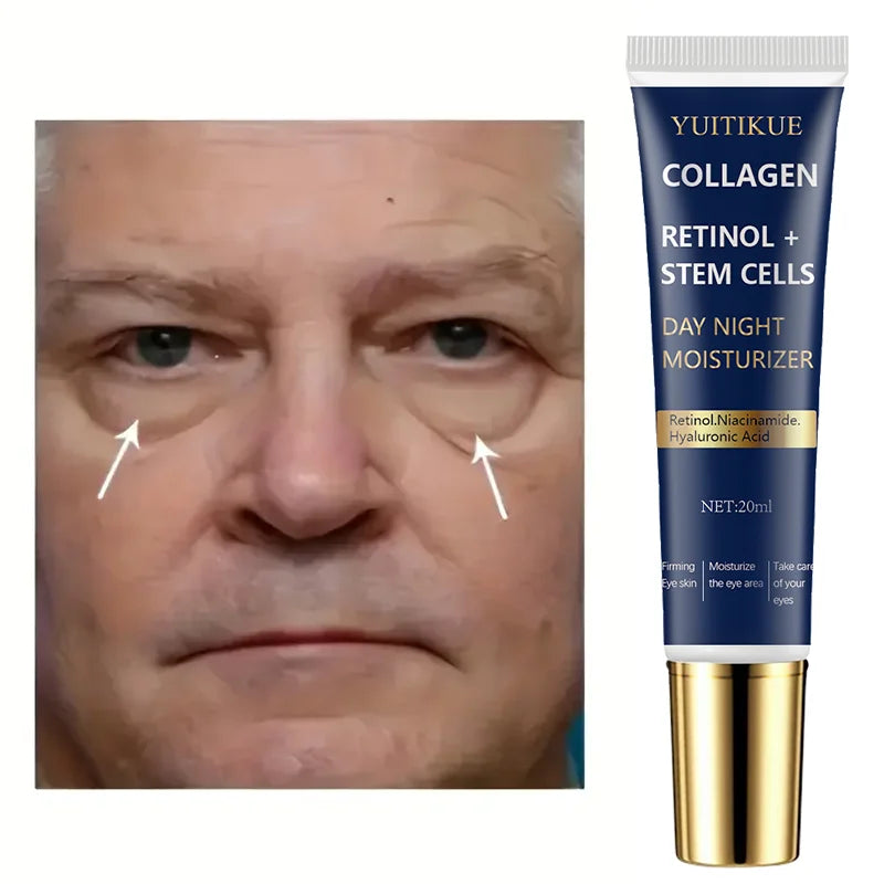 Collagen & Retinol Eye Cream 20ml – Firms & Smooths Eye Area Eye Cream Zpaxo